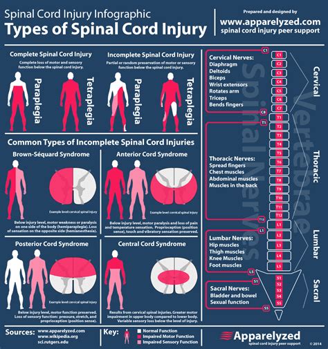 Incomplete Spinal Cord Injury Infographic กายภาพบำบัด ชีววิทยา การศึกษา