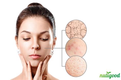 Dry Facial Skin What Is The Cause Nutigood Healthy Diet