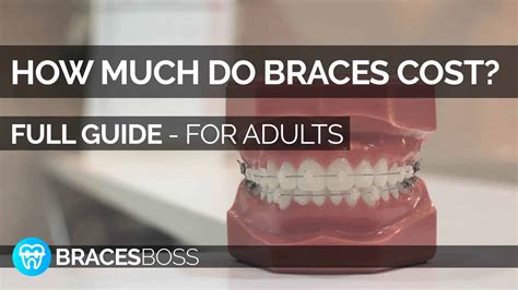 How Much Do Braces Cost For Adults Full Pro Guide 2023 Bracesboss
