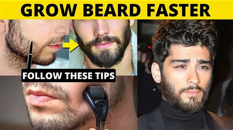 How To Grow Beard Faster Fix Patchy Beard Naturally Mens Grooming हिंदी में Youtube