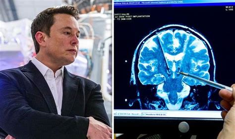 elon musk plans brain implants that will merge humans with ai creating cyborgs ya libnan