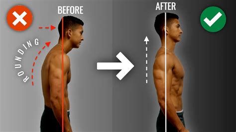 How To Repair Rounded Shoulders Fast 10 Minute Science Primarily Based