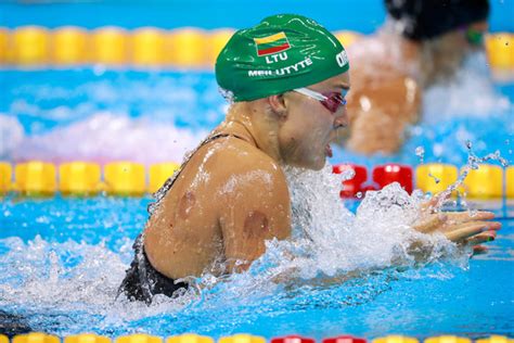 By the way, these women took 1st place. What Are the Purple Dots on Michael Phelps? Cupping Has an ...
