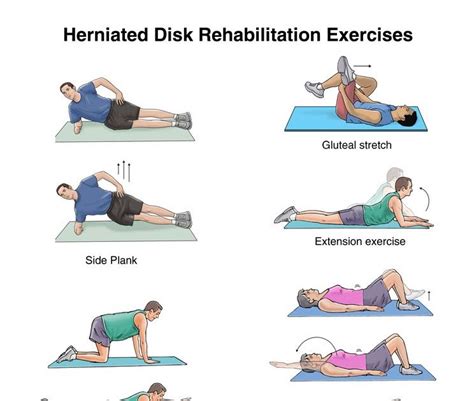 Physical Therapy Exercises For Slipped Disc In Lower Back Exercisewalls
