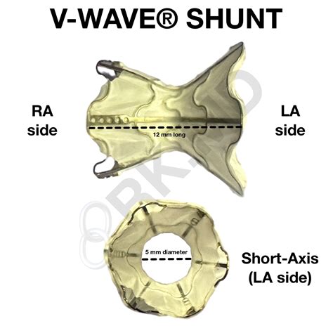 V Wave® Ventura® Interatrial Shunt Rkmd