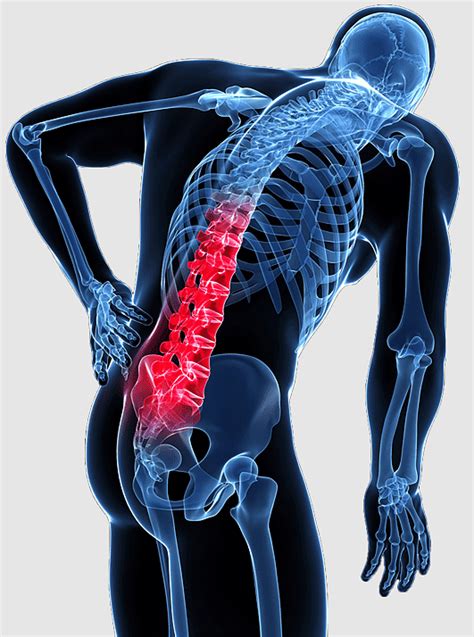 Sacroiliac Joint Sciatic Nerve Sciatica Low Back Pain Neurologist Hot Sex Picture