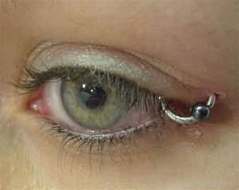 Eyelid Piercing