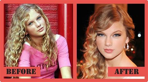 Taylor Swift Plastic Surgery Rumors Were Never Confirmed Plastic