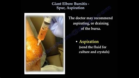 Elbow Bursitis Drainage