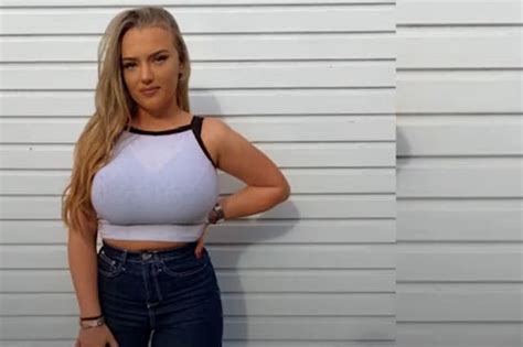 Student Warned Her J Breasts Could Crush Her Spine Has Them Reduced In A Private Op
