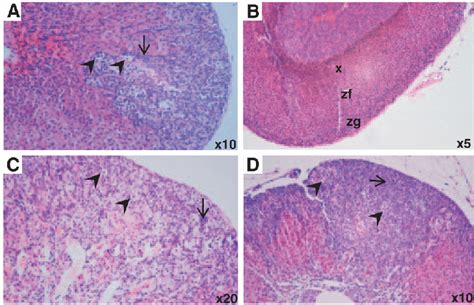 Figure From Adrenal Gland Tumorigenesis After Gonadectomy In Mice Is