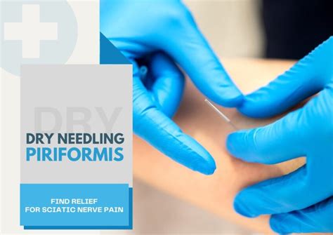 Dry Needling Piriformis Find Relief For Sciatic Nerve Pain