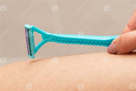 Foliculitis On Hairy Skin Shaving Stock Image Image Of Infected
