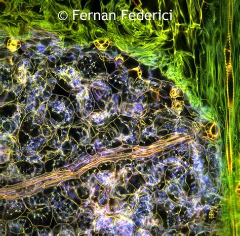 Microscope World Blog Plant Tissue Under The Microscope