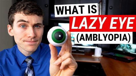 What Is Lazy Eye Amblyopia And What Causes It Eye Health Health