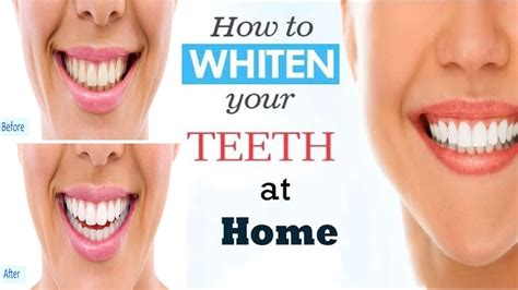 How To Whiten Your Teeth Instantly At Home Teeth Whitening Home Remedies Youtube
