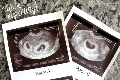 6 Weeks Pregnant With Twins Update Budget Savvy Diva