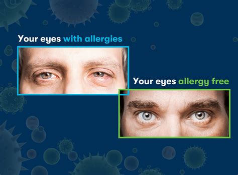 Can You Develop Allergies As An Adult Immuno Labs