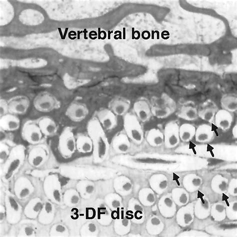 Histologic Findings Of The 3 Df Disc After Implantation In Sheep Lumbar