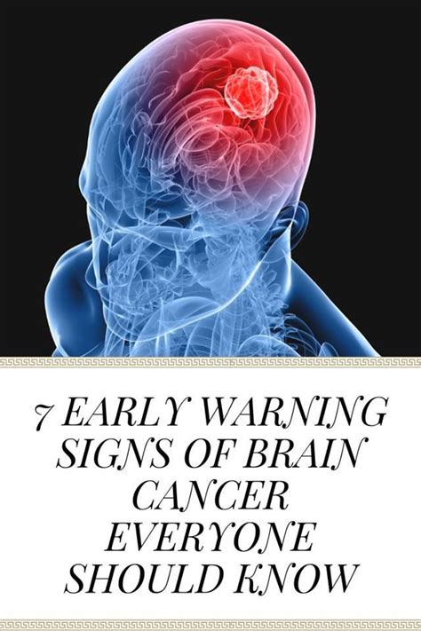 Brain Cancer Early Signs Brain Tumor Cancer