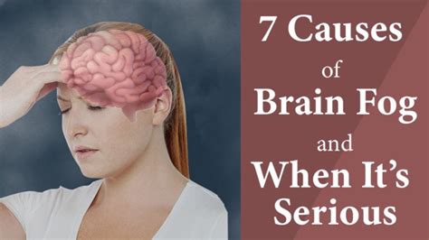 7 Causes Of Brain Fog And How To Know When Its Really Serious