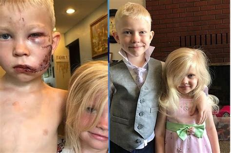 Celebrities laud 6-year-old heroic boy saving little sister from a dog ...