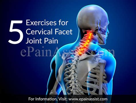 5 Exercises For Cervical Facet Joint Pain