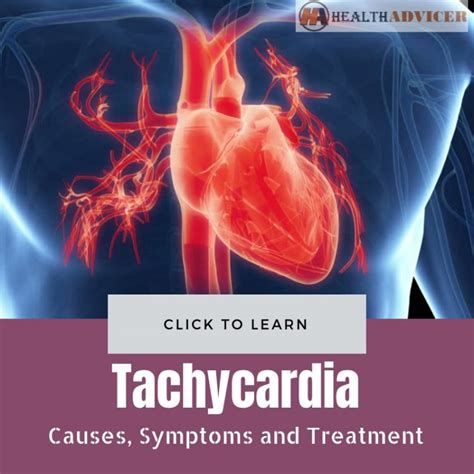 Tachycardia Causes Picture Symptoms And Treatment