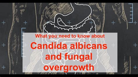 What You Should Know About Candida Albicans And Fungal Overgrowth Youtube