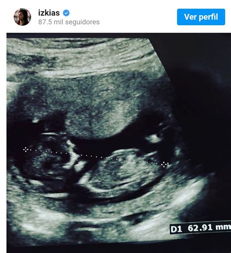 ¡habemus guagüita!, indicó, comentando además que tenía 12+5 semanitas, publicación que sólo sacó aplausos. Noticias Chile | Izkia Siches está embarazada - Noticias ...
