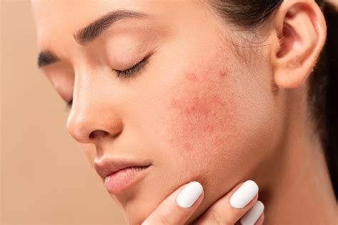Skin Problems Get Treatment Kit And Advice From Best Dermatologists