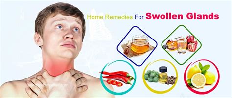 25 Effective Home Remedies For Swollen Glands In Neck And Throat