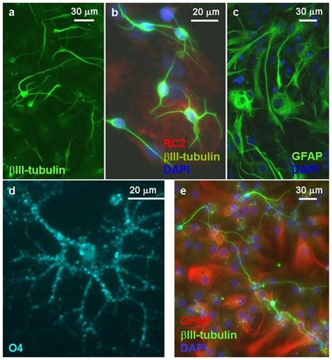 Neural Differentiation Of Radial Glia Like Cells Withdrawal Of Egf