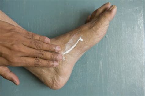 Foot Rash Causes Symptoms Home Remedies And Treatment