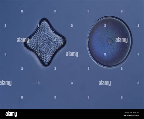 Diatoms From The Sea Under The Microscope 100x Stock Photo Alamy