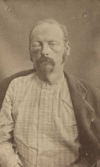 Cole Younger After Being Captured Mnopedia