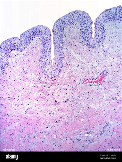 Mucosa Of The Urinary Bladder Formed By A Transitional Epithelium And A