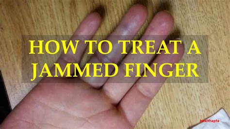 How To Treat A Jammed Finger Youtube