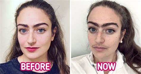 A Woman Stopped Removing Facial Hair And A Year Later Shares How It