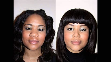 African American Female Rhinoplasty Nyc Before And After Dr Sam Rizk