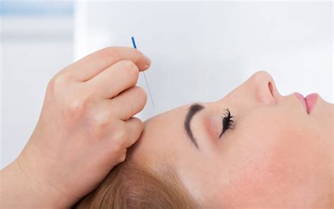 7 Potential Health Benefits Of Acupuncture Publicist Paper