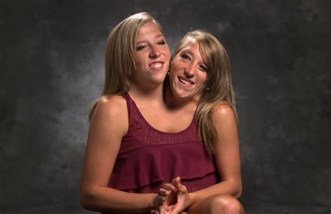 The Conjoined Twins Who Just Turned 27 Years Old Have Made An Important