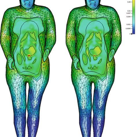 PDF Using Anatomical Human Body Model For FEM SAR Simulation Of A 3T