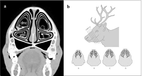 Cross Sectional Images Of The Nasal Turbinate Structures From The