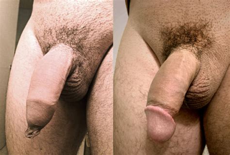 Circumcised Male Nudes Igfap