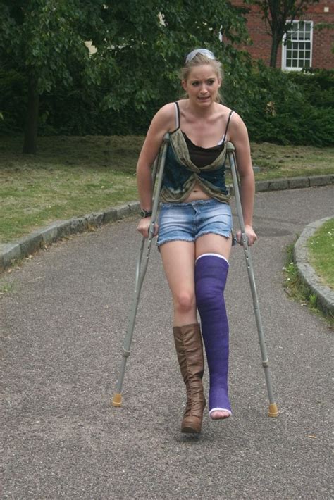 16092010 6 683×1024 Pixels Leg Cast Long Leg Cast Crutches