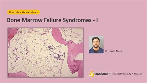 Bone Marrow Failure Syndromes Hematology Medicine