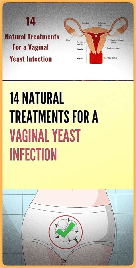 Natural Treatments For A Vaginal Yeast Infection Wellness Days