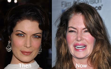 53 Celebrity Plastic Surgery Gone Wrong With Photos