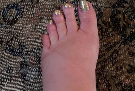 Pregnant Jessica Simpson Reveals Photo Of Her Swollen Feet And Asks For Help And The Answers